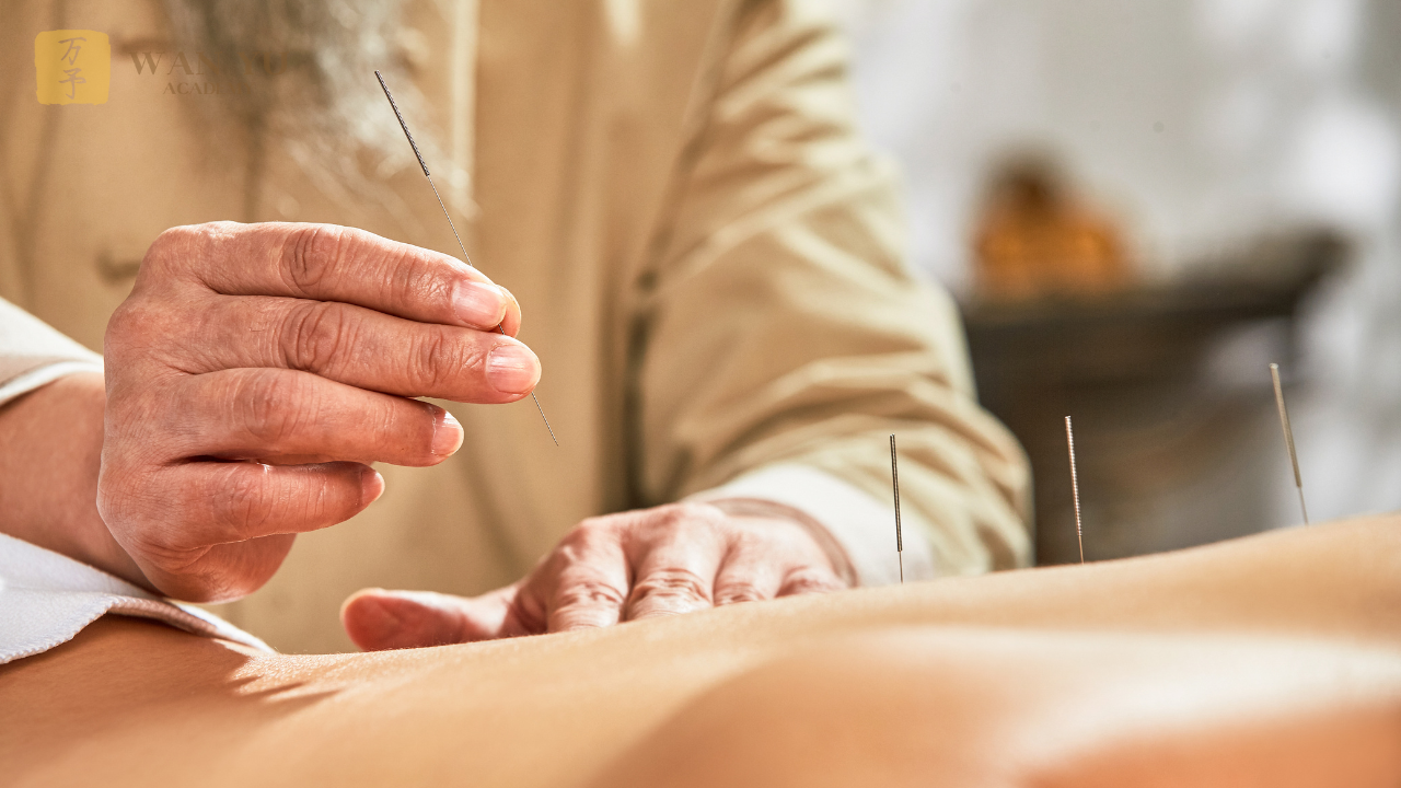 Các Phương Pháp Chữa Bệnh Trong Y Học Cổ Truyền Trung Quốc Châm Cứu (Acupuncture)